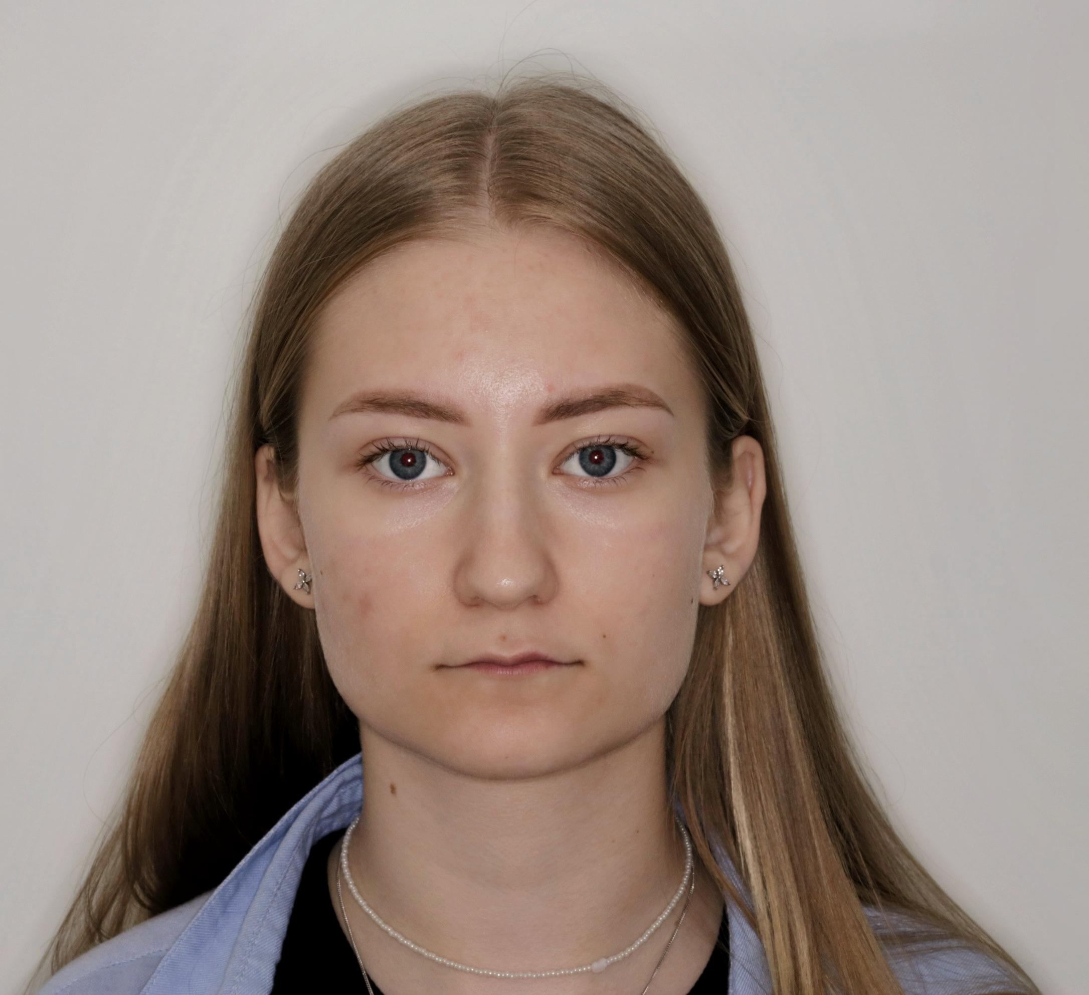 Пациент до
